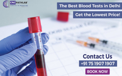 The Best Blood Tests in Delhi: Get the Lowest Price!