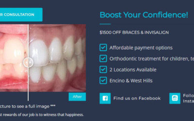 CaliSmile Orthodontics aims to give everyone who passes through our doors a smile that shines with confidence and pride in West Hills and Encino.