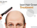 hair-loss-light-therapy-fresno-small-0