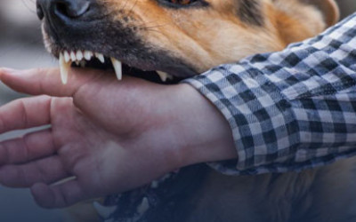 Dog Bite Accident Lawyer Palm Springs